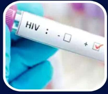 HIV पॉजिटिव