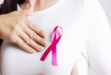 स्तन कैंसर